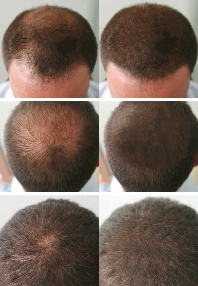Hair Spa Treatment In Hindi Hair Spa Treatment In Hindi