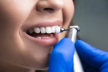 1632808431teeth-cleaning.jpg